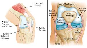 Back Pain